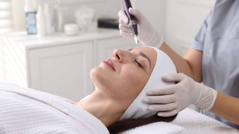 Microneedling: Unlocking Your Skin's Potential with Tiny Needles