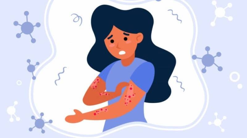 Measles Outbreak in Rajshahi: 40 Child Deaths and Rising Concerns