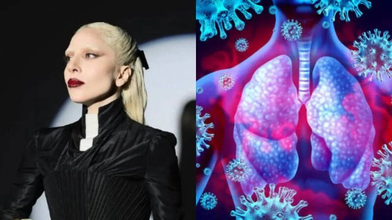 Lady Gaga Tour Cancelled: Understanding Respiratory Infections and Vocal Health