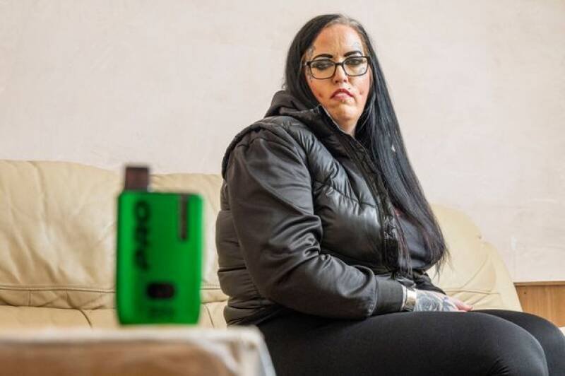 Vaping and Teeth: Woman's Story Highlights Hidden Dangers