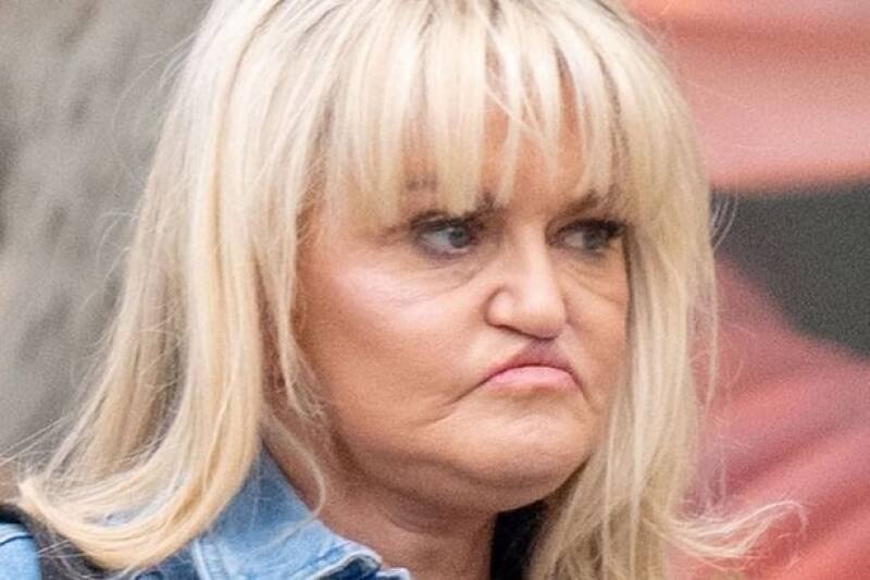 Danniella Westbrook's Transformation: Exploring Her Facial Reconstruction Journey