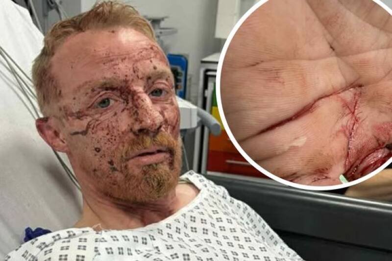 Samurai Sword Attack in Penzance Leaves Dad Unable to Communicate With Deaf Son