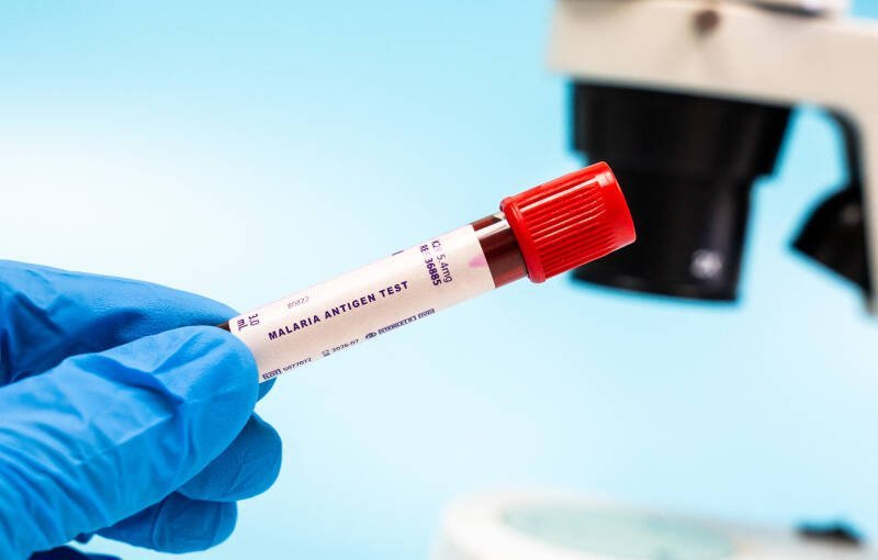 Gauteng Malaria Alert: Understanding the Rise in Imported Cases